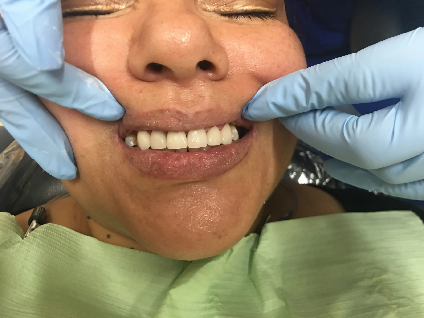 Flex Dental patient smile after treatment